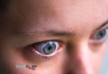 గ్రేవ్స్ వ్యాధి గురించి తెలుసా.? చికిత్సా విధానాలు, మందులు Graves' disease_ Medications and other treatments