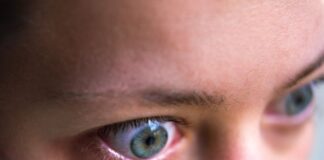 గ్రేవ్స్ వ్యాధి గురించి తెలుసా.? చికిత్సా విధానాలు, మందులు - Graves' disease: Medications and other treatments Graves' disease_ Medications and other treatments