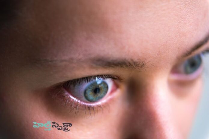 Graves' disease_ Medications and other treatments