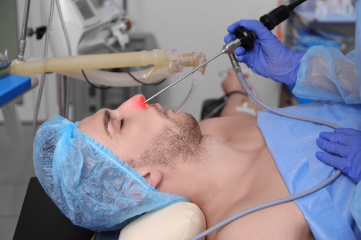 Treatment of Nasal polyps
