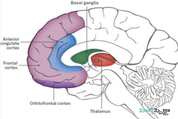 What causes OCDWhat causes OCD