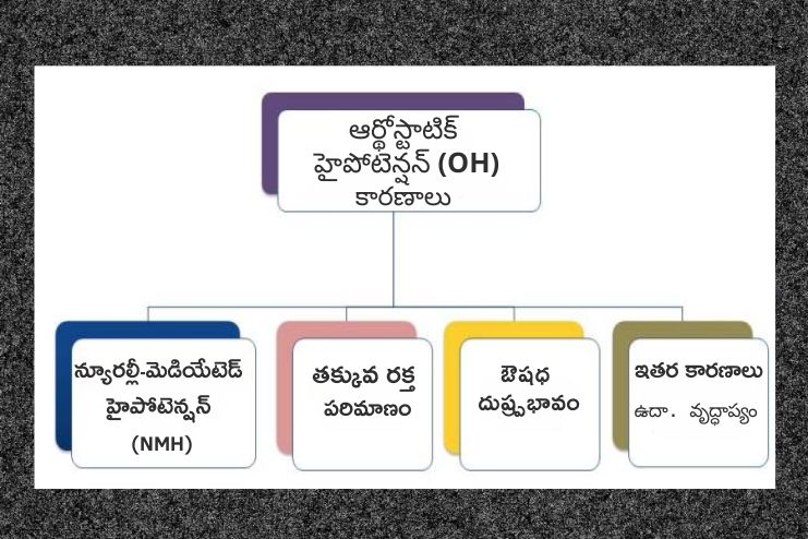 Causes of orthostatic hypotension