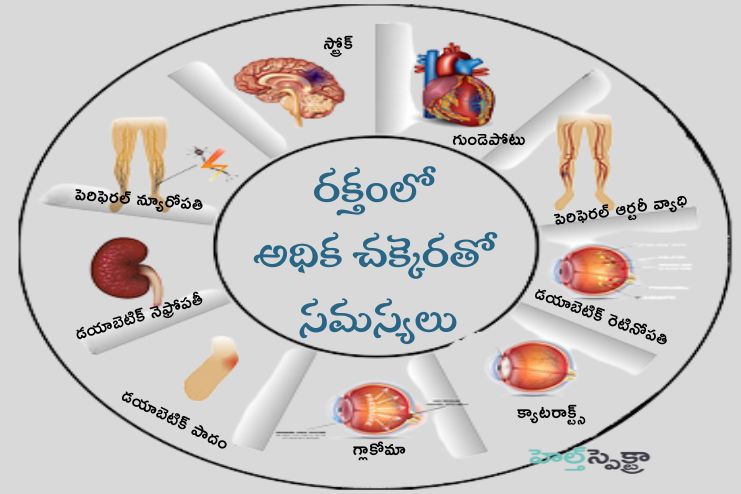 Consequences of high glucose in the blood
