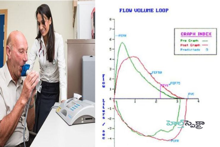 Diagnosis of Chronic Cough