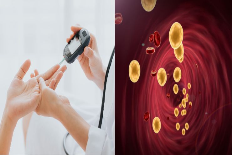 type 2 DM and cholestrol