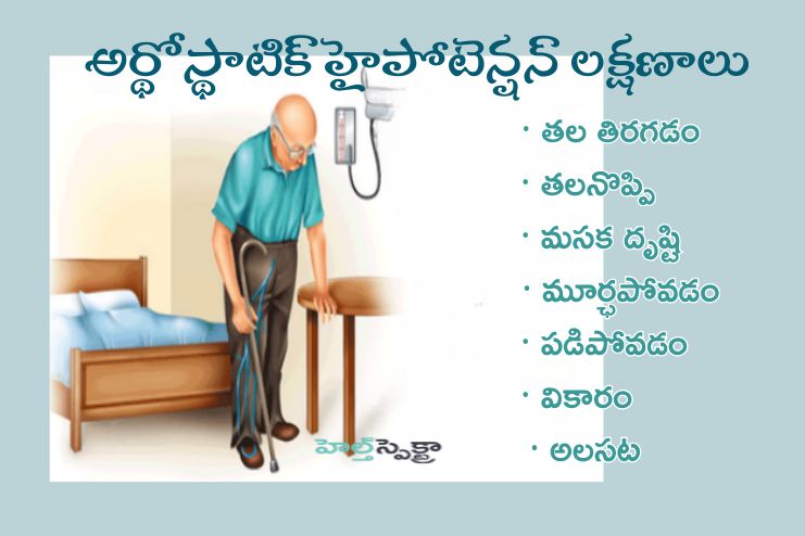 Symptoms of orthostatic hypotension