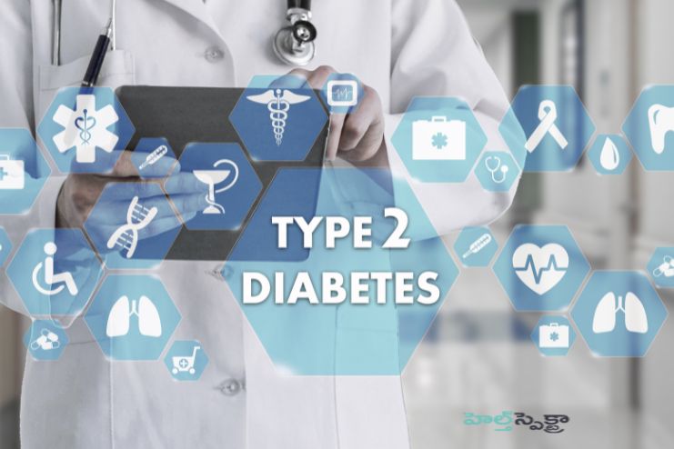Type 2 diabetes