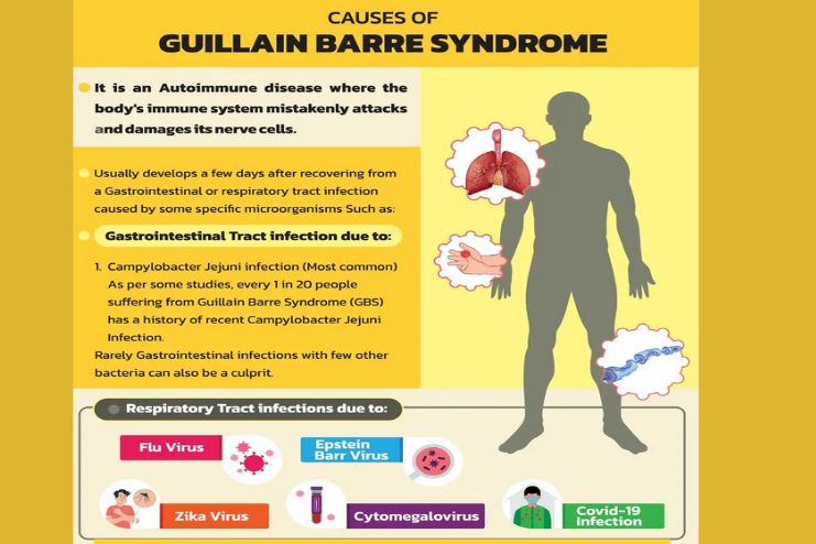 Causes of Guillain-Barre syndrome