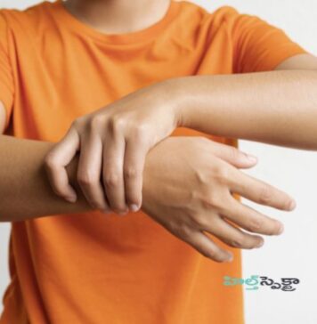 గుల్లెయిన్-బారే సిండ్రోమ్: లక్షణాలు, కారకాలు, చికిత్స Guillain-Barre syndrome