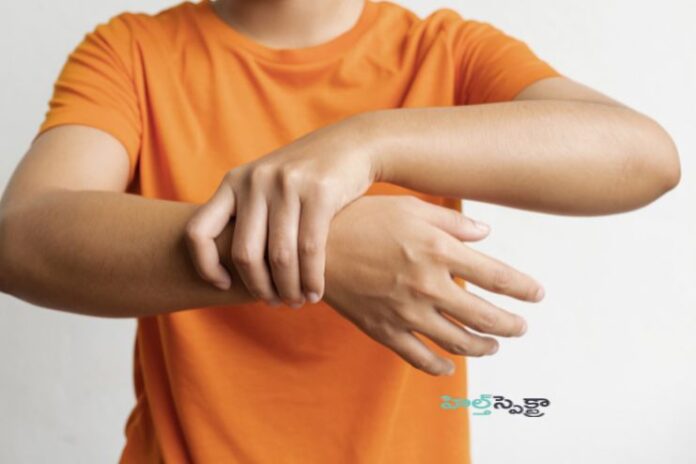 Guillain-Barre syndrome