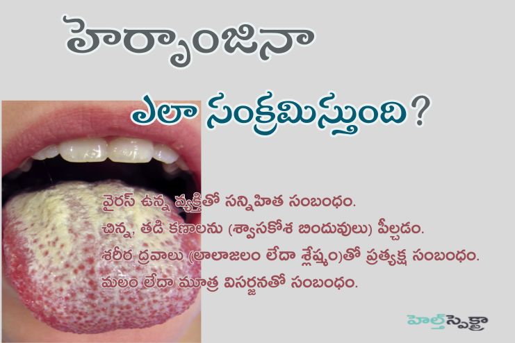 Is Herpangina contagious