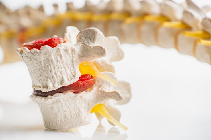 Preventing neurodegenerative diseases