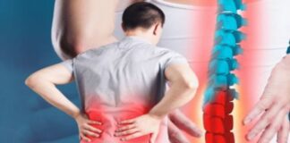 సయాటికా నొప్పి: లక్షణాలు, కారకాలు, చికిత్స, నివారణ - Sciatica: Symptoms, Causes, Treatment and Prevention Sciatica- Causes, Symptoms, and Treatment