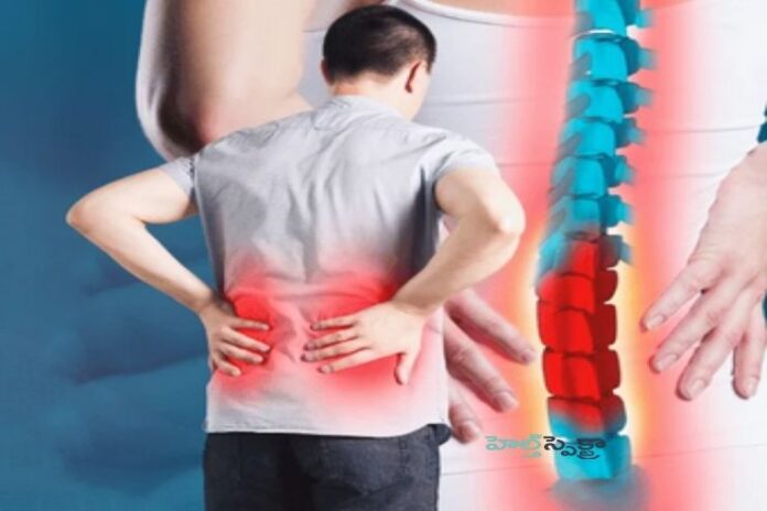 Sciatica- Causes, Symptoms, and Treatment