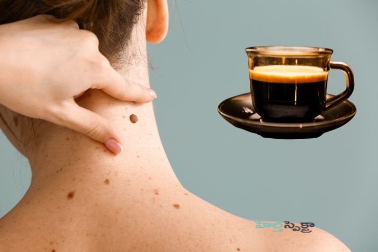 Reduce melanoma risk