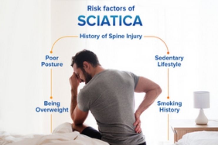 Risk factors for Sciatica pain