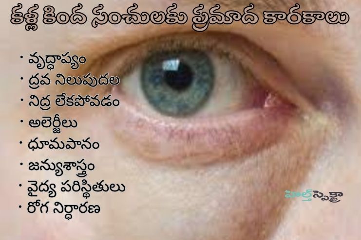 Risks factors of Puffy Eyes