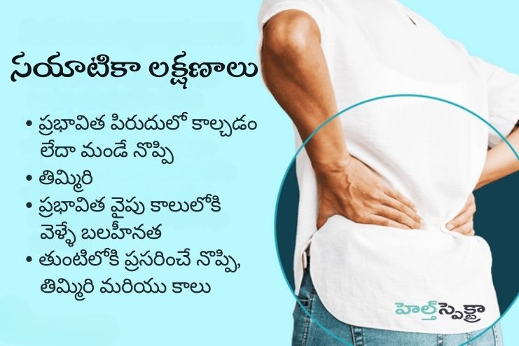 Symptoms of Sciatica pain