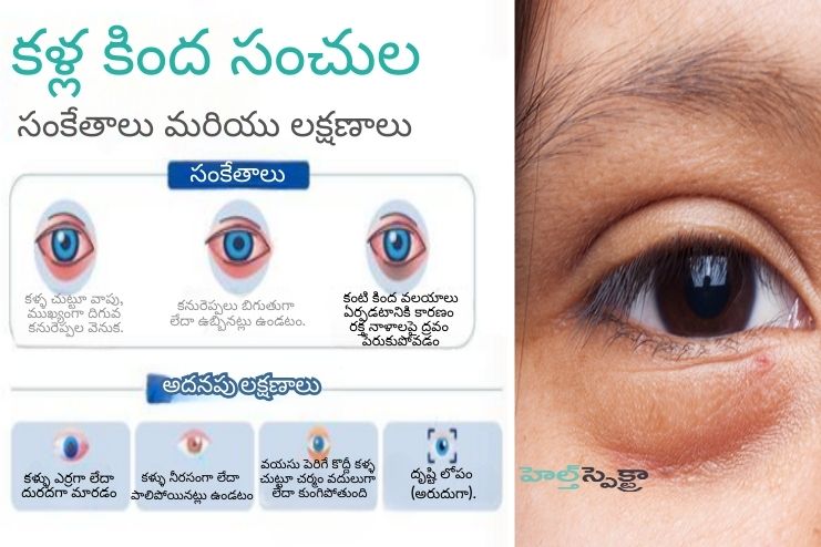 Symptoms of puffy eyes