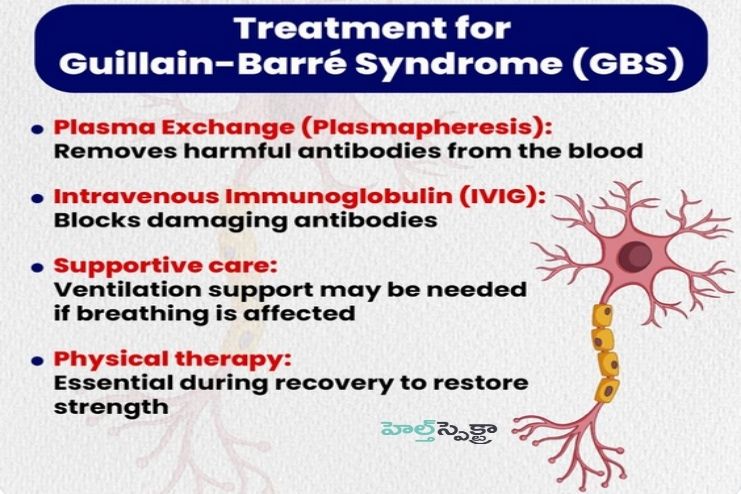 Treatment for Guillain-Barre syndrome