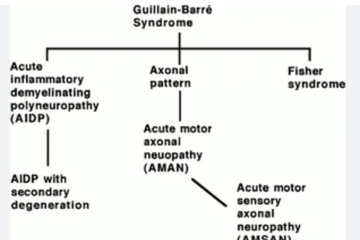 Types of Guillain-Barre syndrome