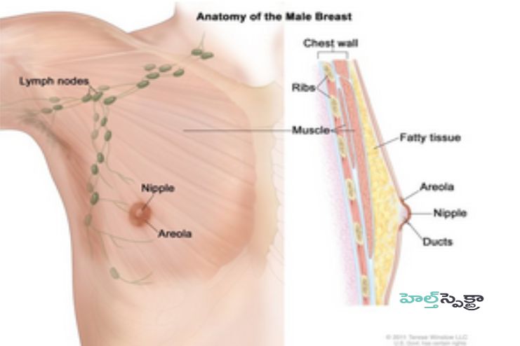 Where breast cancer begins in men