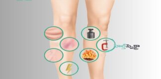 రక్తం గడ్డకట్టే 8 హెచ్చరిక సంకేతాలు ప్రమాదకరమా? - Are these 8 Warning Signs of Deep Blood Clots Dangerous? Are these 8 Warning Signs of Deep Blood Clots Dangerous