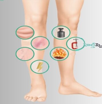 రక్తం గడ్డకట్టే 8 హెచ్చరిక సంకేతాలు ప్రమాదకరమా? Are these 8 Warning Signs of Deep Blood Clots Dangerous