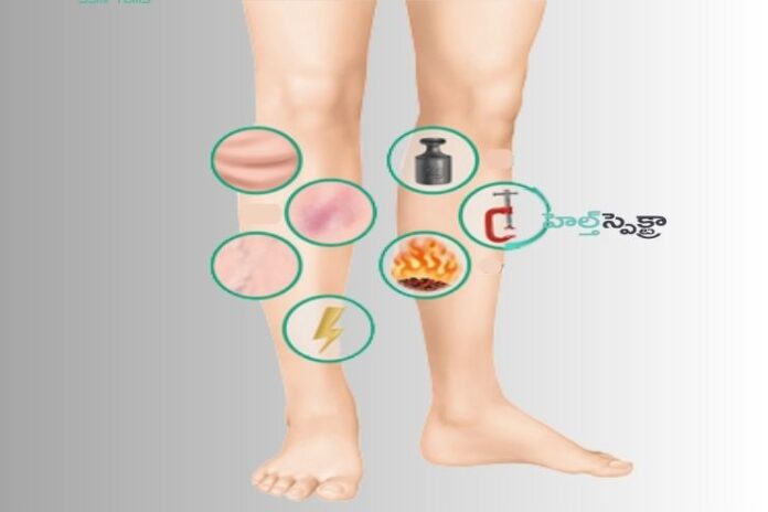 Are these 8 Warning Signs of Deep Blood Clots Dangerous