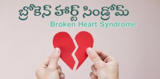 బ్రోకెన్ హార్ట్ సిండ్రోమ్: కారణాలు, లక్షణాలు మరియు చికిత్స - Broken heart syndrome: Causes, Symptoms and Treatment Broken heart syndrome_ Causes, Symptoms and Treatment