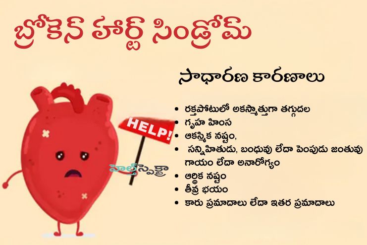 Causes of broken heart syndrome