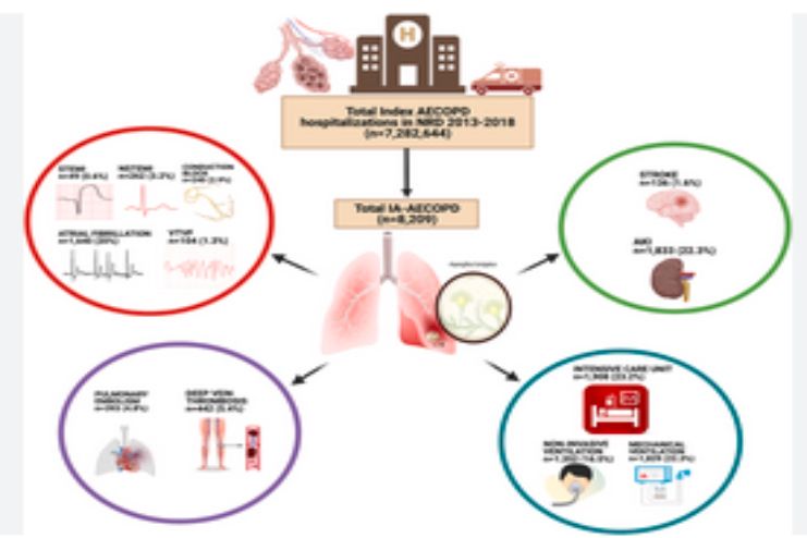 Complications of Aspergillosis