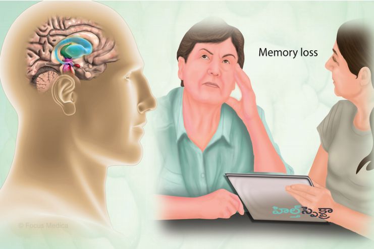 Complications of Creutzfeldt-Jakob diseas
