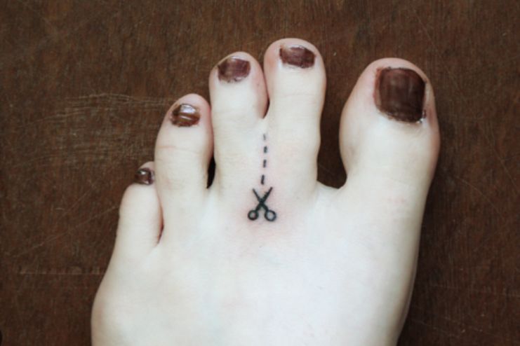 Do Webbed Toes Need Correcting