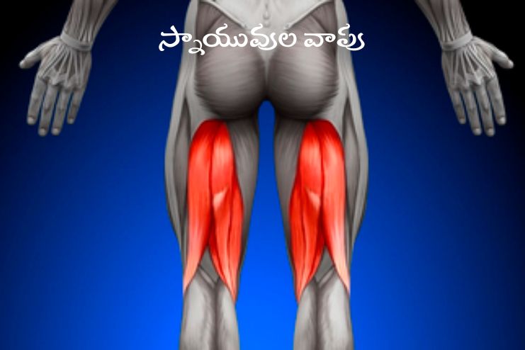 Hamstring Tendonitis