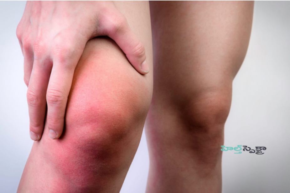 How Do You Diagnose PVNS