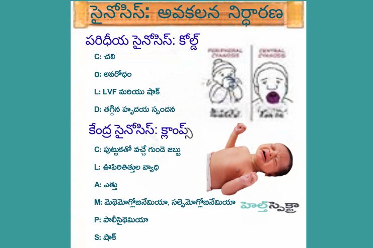 How Is Cyanosis Diagnosed