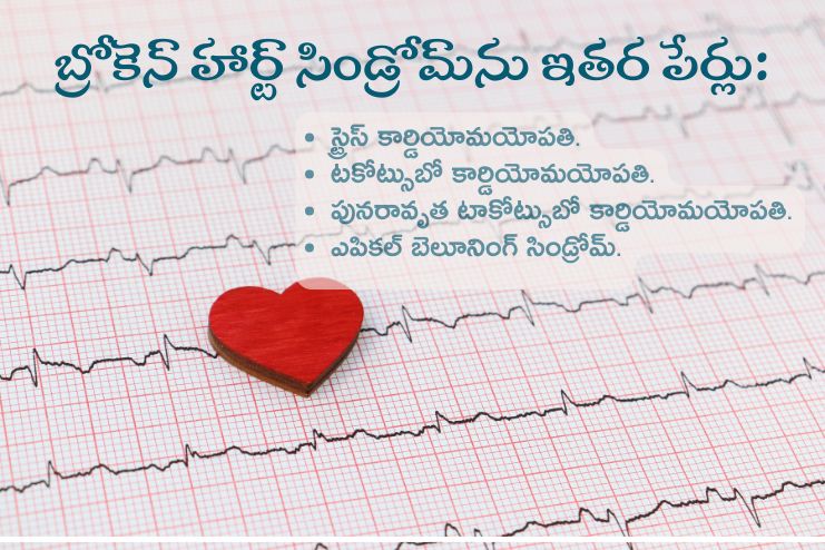 Other names for broken heart syndrome