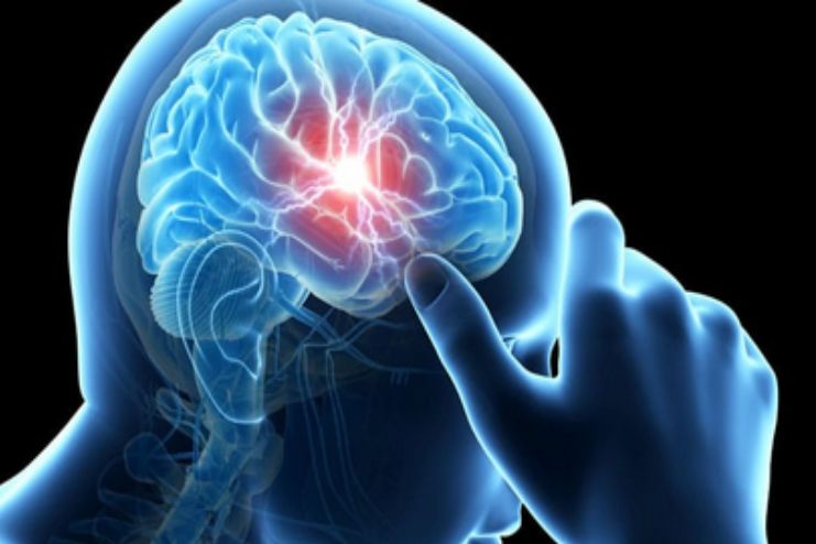 Preventing variant Creutzfeldt-Jakob diseas