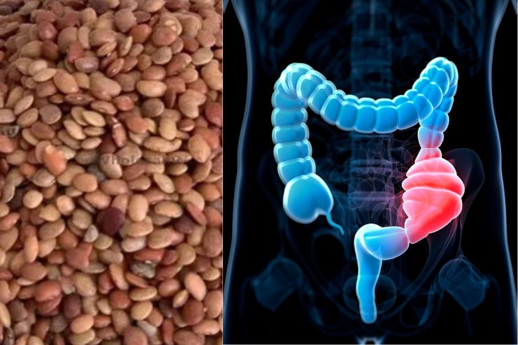 Relieves Constipation to Some Extent