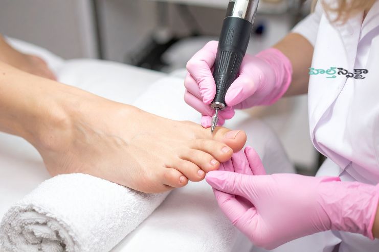 Surgery for Webbed Toes