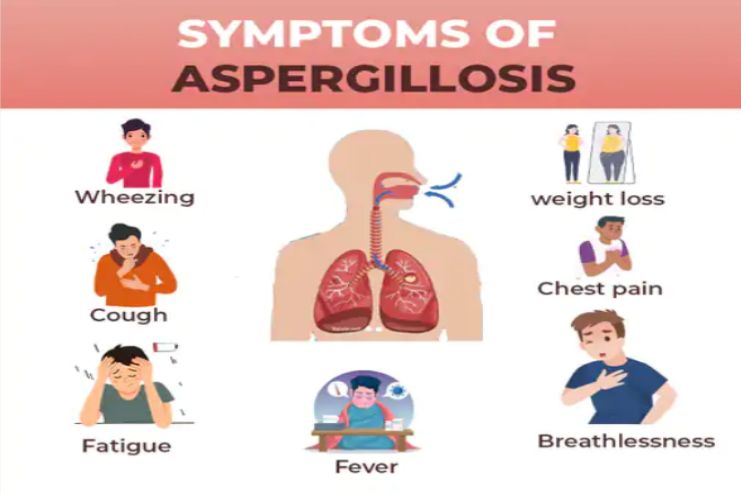 Symptoms of Aspergillosis