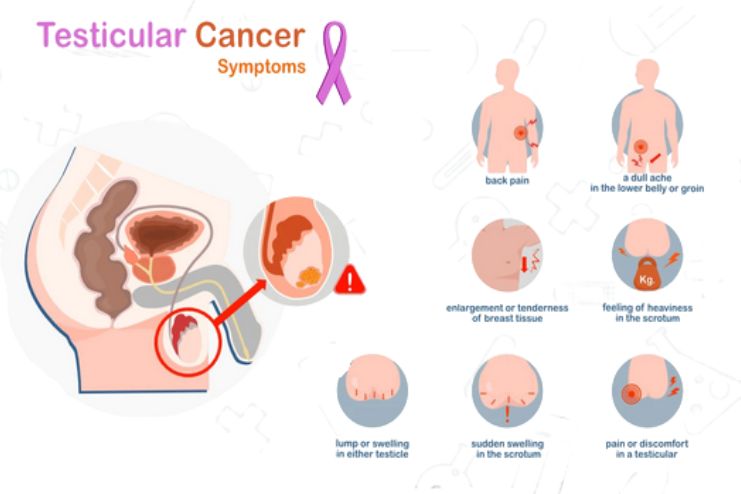 Testicular cancer