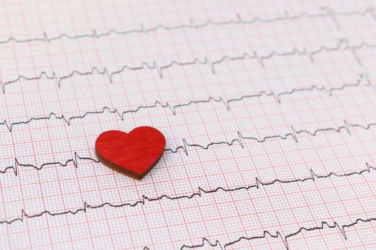 What’s Happening With Heart Palpitations