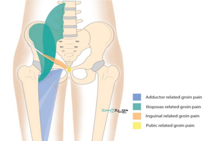 When to Be Concerned About Groin Pain