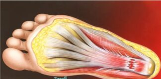 పాదం అడుగు భాగంలో నొప్పికి 10 కారణాలు, చికిత్సలు - Bottom-of-Foot Pain- Causes, Symptoms, and Treatments Bottom-of-Foot Pain- Causes, Symptoms, and Treatments