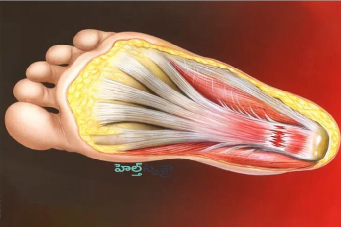 Bottom-of-Foot Pain- Causes, Symptoms, and Treatments