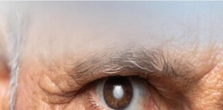 కంటిశుక్లం – కారణాలు, లక్షణాలు, చికిత్స & నివారణ - Cataract: Causes, Symptoms, Treatment and Prevention Cataract: Causes, Symptoms, Treatment and Prevention