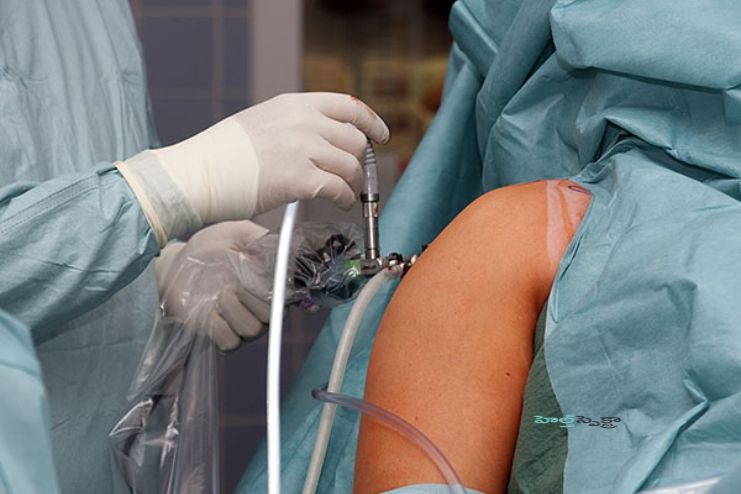 భుజాలకు జరిగే ఎనమిది రకాల శస్త్రచికిత్సలు తెలుసా.? - <span class='sndtitle'></img>Exploring 8 Common Shoulder Surgery Procedures </span>