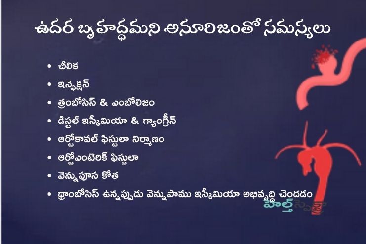 Complications of AAA